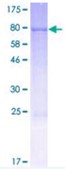 SDS-PAGE (FMO3-856H).jpg